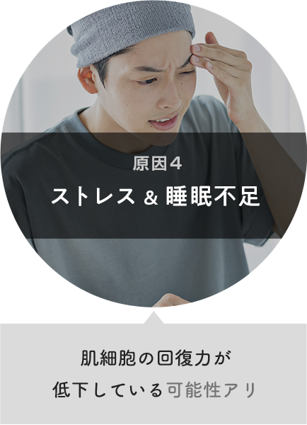 原因４：ストレス&睡眠不足 肌細胞の回復力が低下している可能性アリ